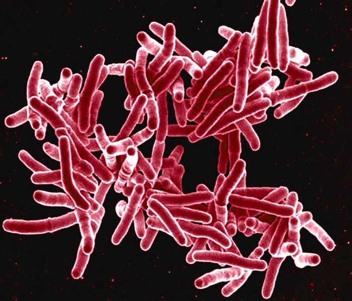 Tuberculosis Microscope image of tuberculosis