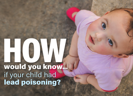 Lead Poisoning Prevention Guidance For Parents And Caregivers | Vermont  Department Of Health