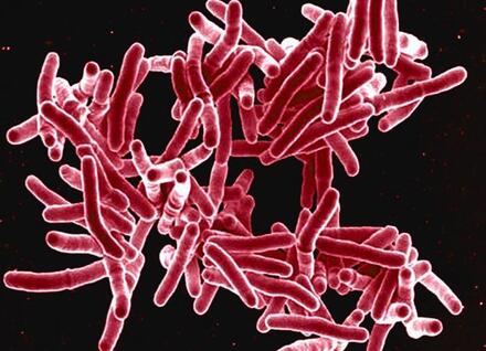 Microscope image of tuberculosis