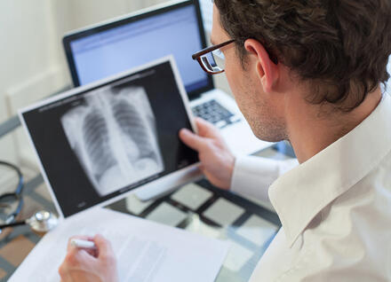 TB x-ray