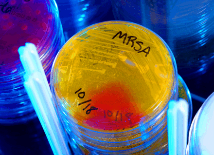 MRSA Petri dish containing MRSA