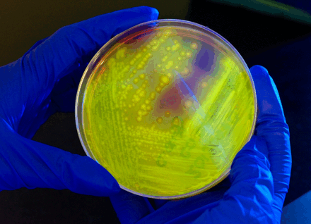 Petri dish containing C. Diff