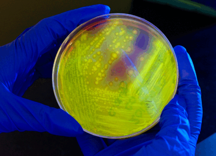 C. Diff Petri dish containing C. Diff
