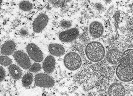 Black and white electron microscopic image of mpox virus