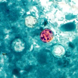 Cyclospora