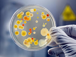 Petri dish with bacteria